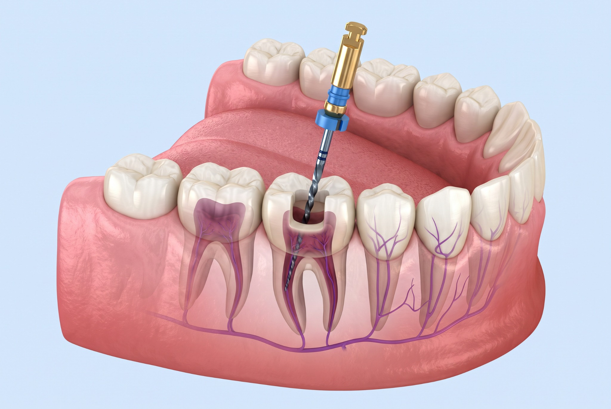 Endodoncia